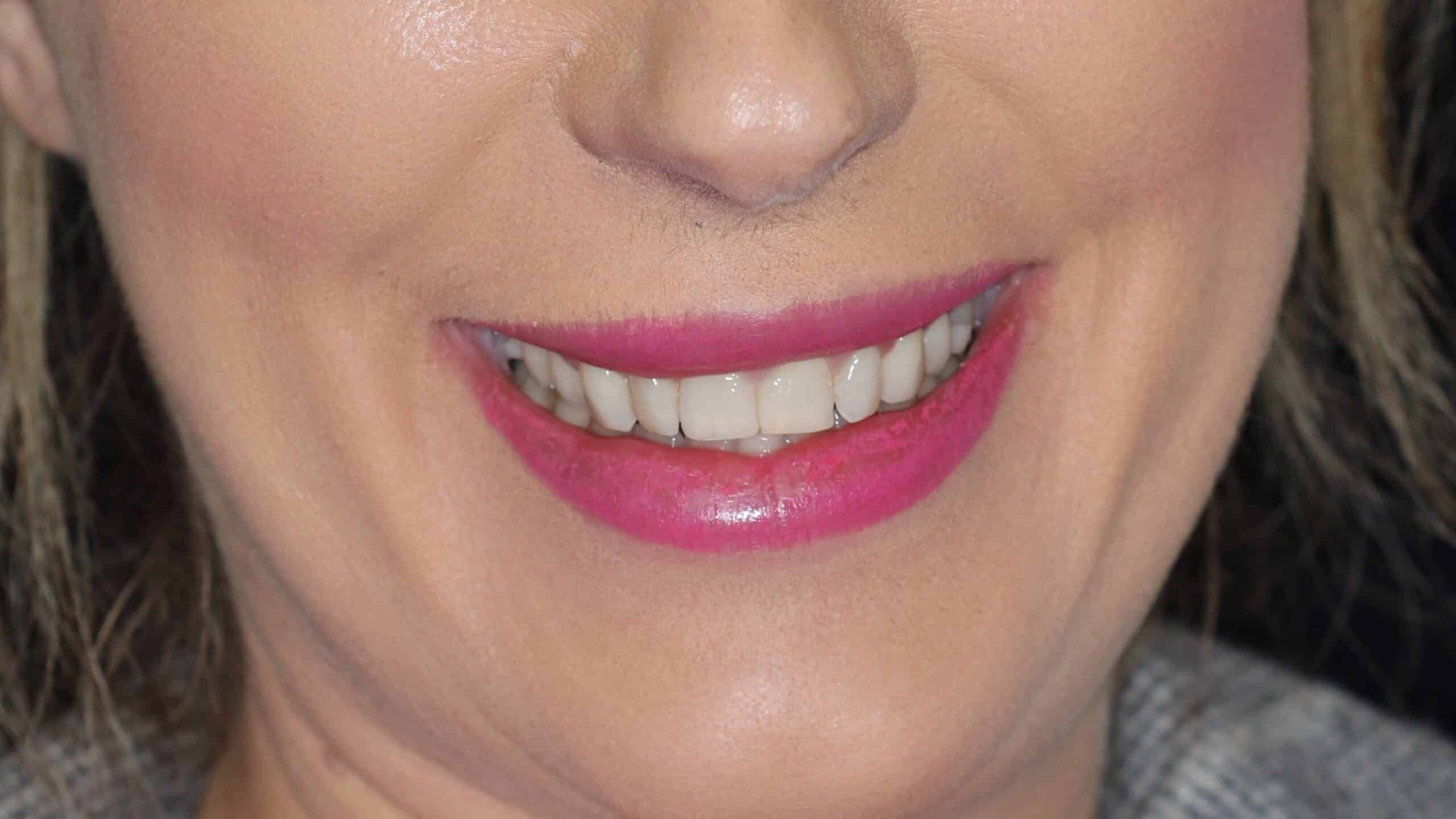 19 Close Up